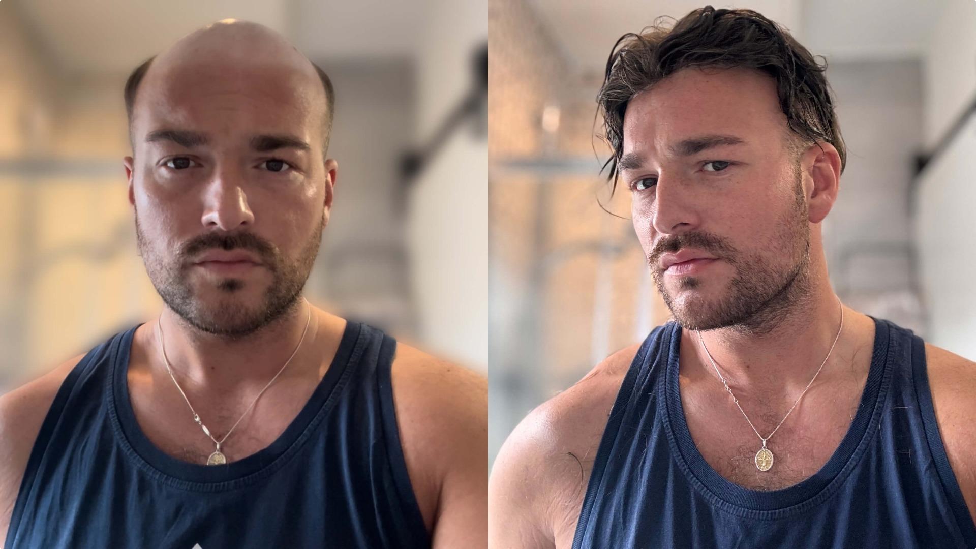 Full French Lace Hair System - Maximum Breathability - Heat-resistant Comfort - Sports-friendly