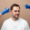 Exosomes Therapy for Hair Loss Recovery and Growth