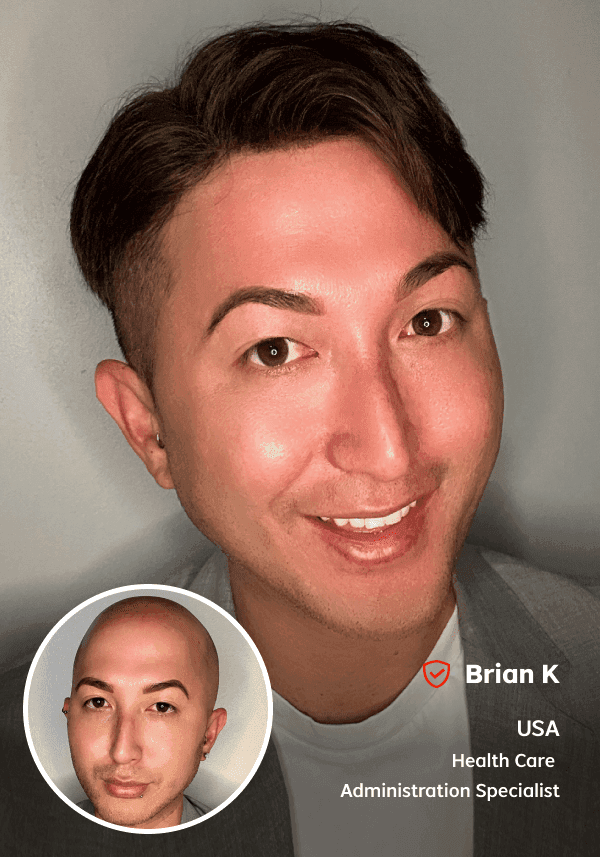 Injected Skin Hairpiece for Men