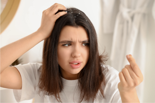 can dandruff cause hair thinning