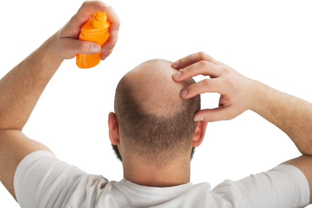 age related hair loss