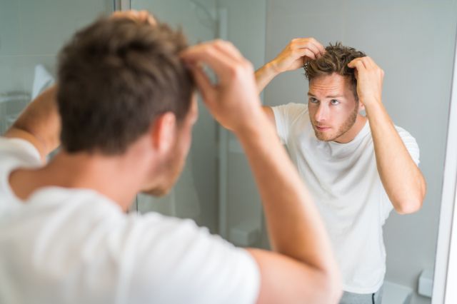 oily scalp and hair loss