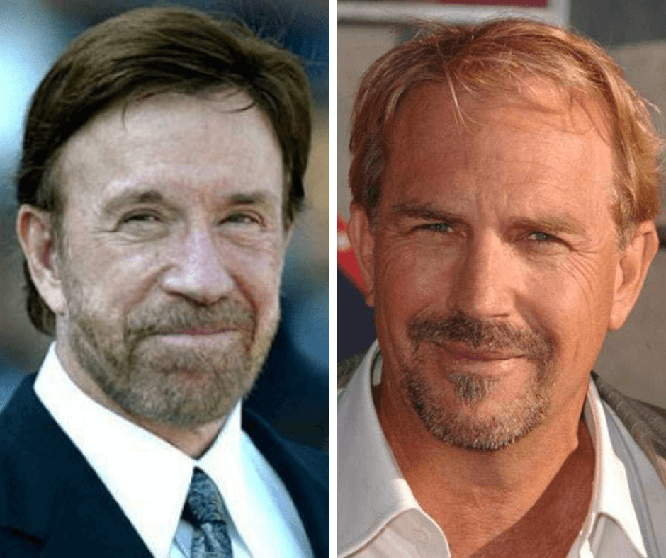 Celebrities With Hair Loss 5027