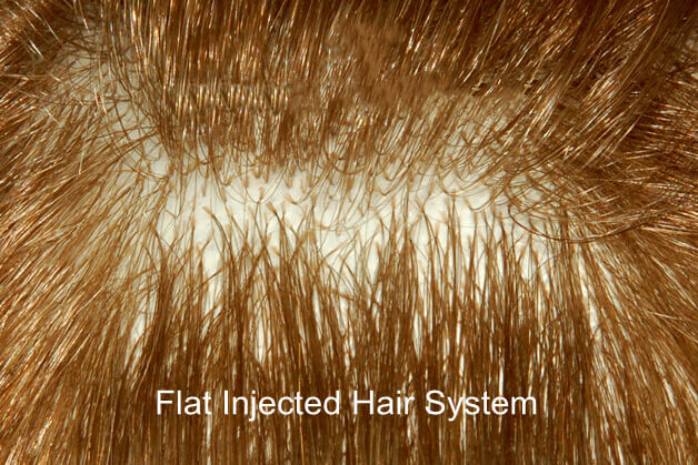 flat injected hair system