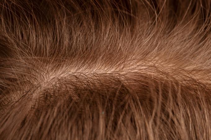 fibers for concealing hair loss 