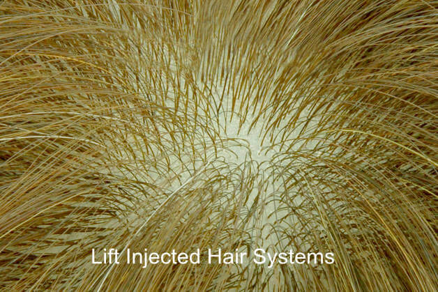 lift injected hair system